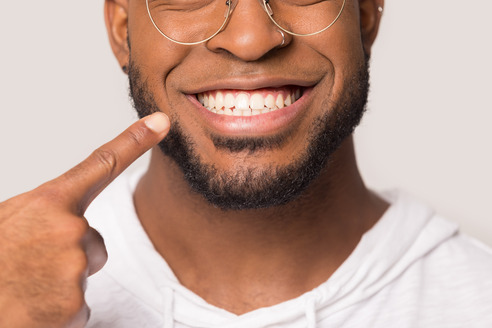 man smiling and pointing to teeth 